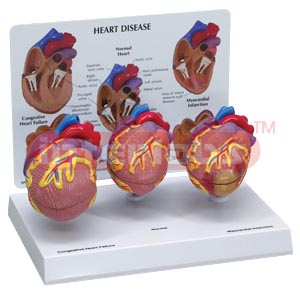 3-pc Mini Heart Set Models